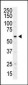PI4K2A  (PI4K II) Antibody (N-term)